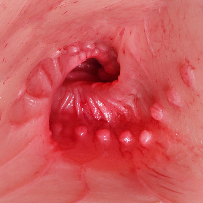 Jennifer, Tantaly, Torso de TPE (STOCK Europa) - Imagen 16